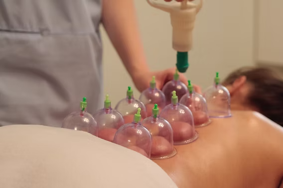 Cupping Therapy (Hijama)